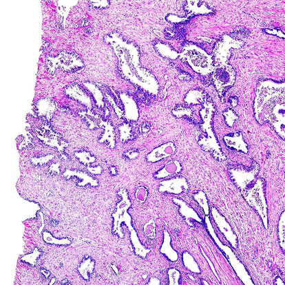 Anatomía patológica - histología